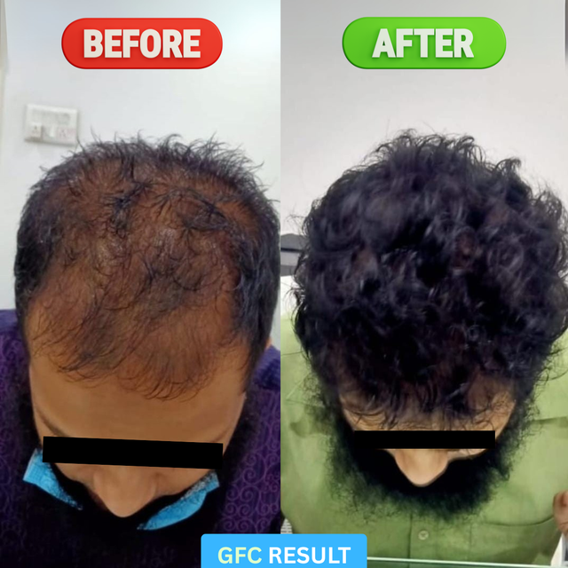 Transformation